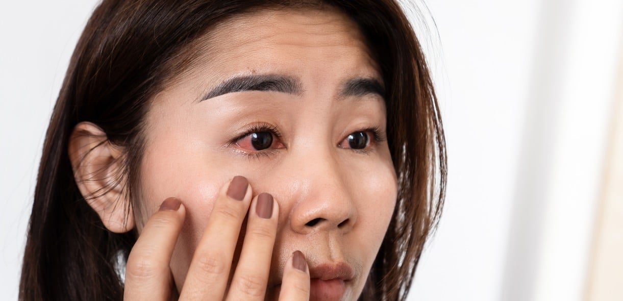 Immediate Actions for Eye Injuries at Home or Outdoors