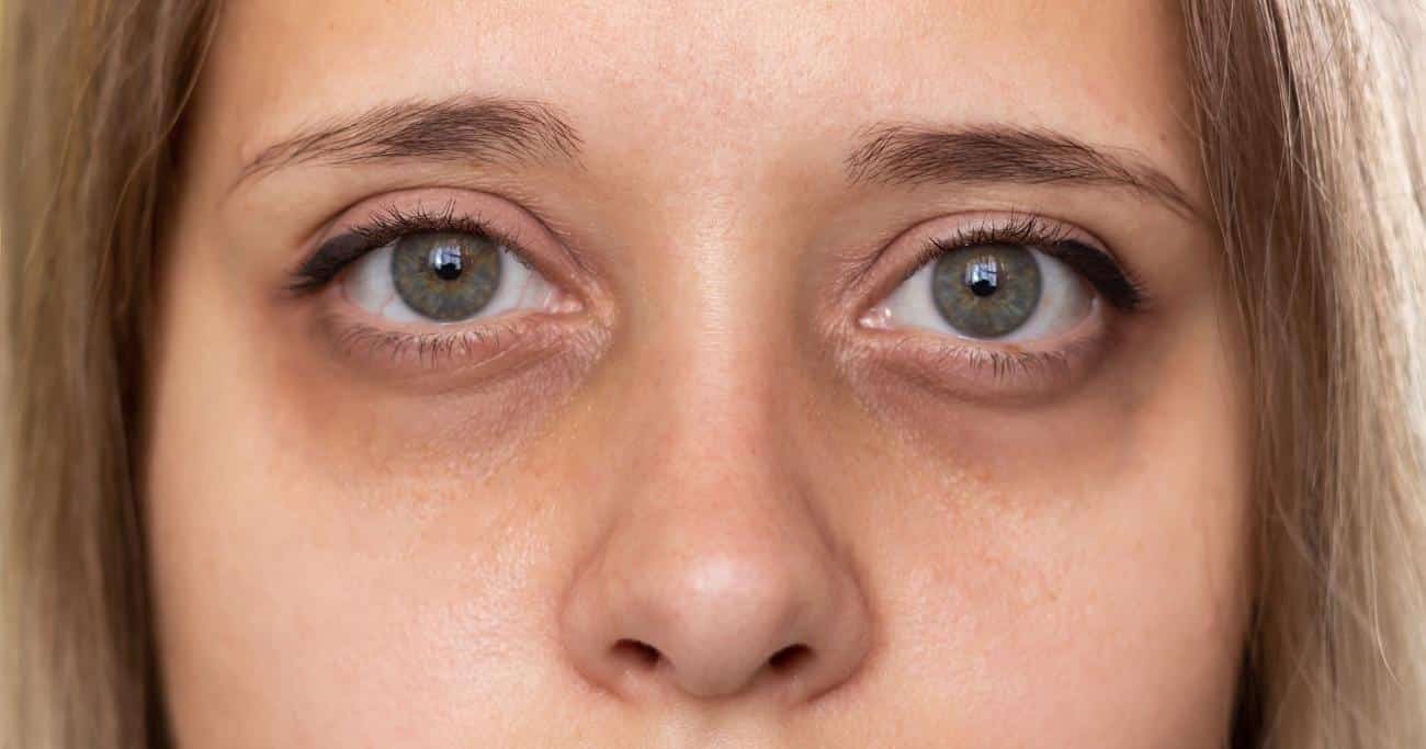 foods to eat for eye health & cataract prevention